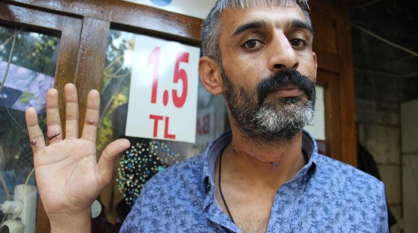 Olayda ağır yaralanan tuvalet bek&ccedil;isi konuştu