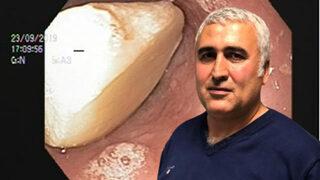 Yemek borusuna takılı kalan sarımsak nedeniyle az daha canından oluyordu