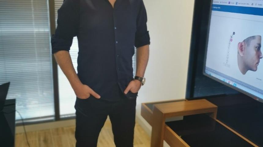 Yanak küçültme daha çekici gösteriyor