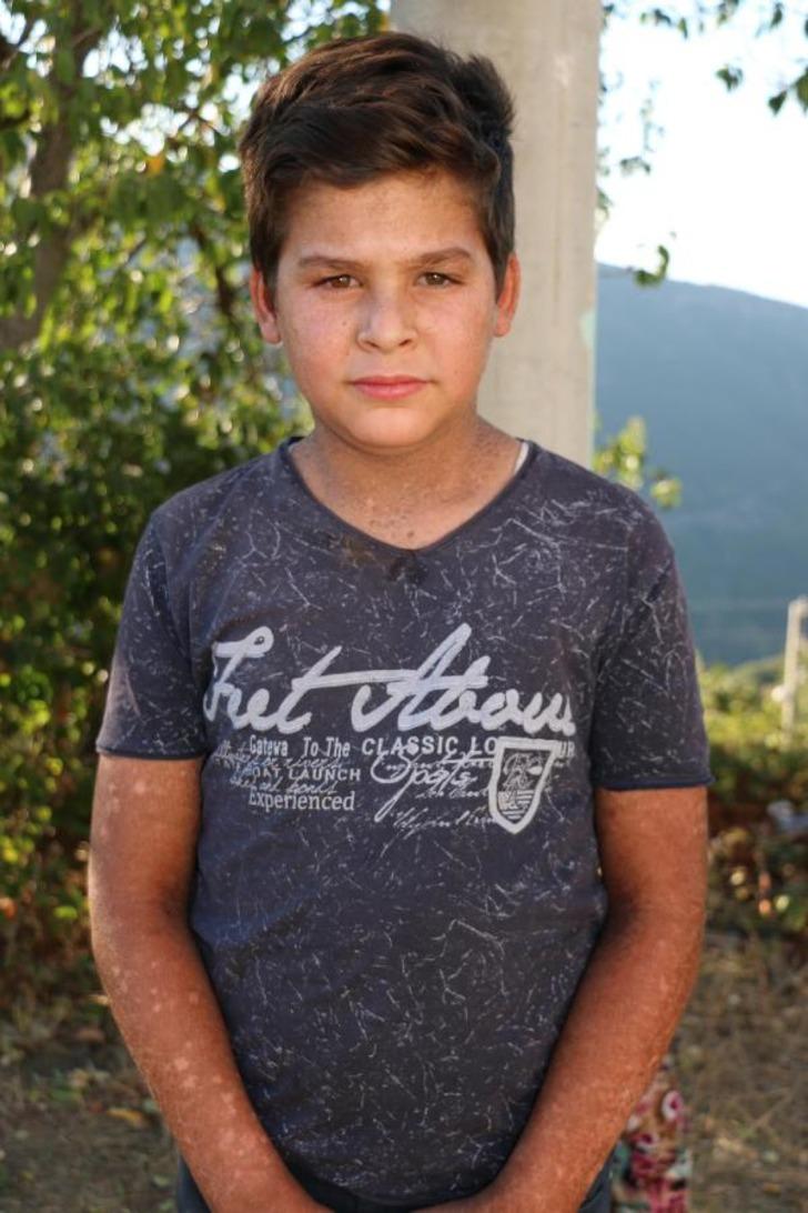 Turgutlu'daki 7 mahallede 'balık pulu' hastalığı! G3