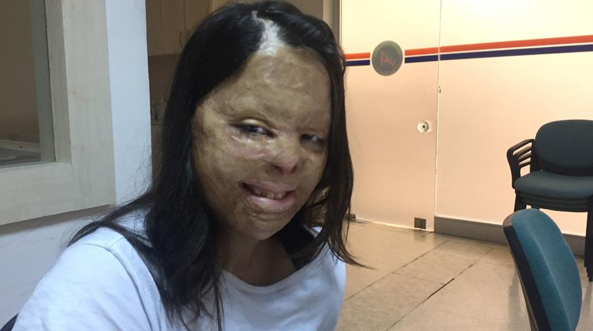 15 yılda 81 ameliyat olan Firdevs yoğun bakımdan çıktı