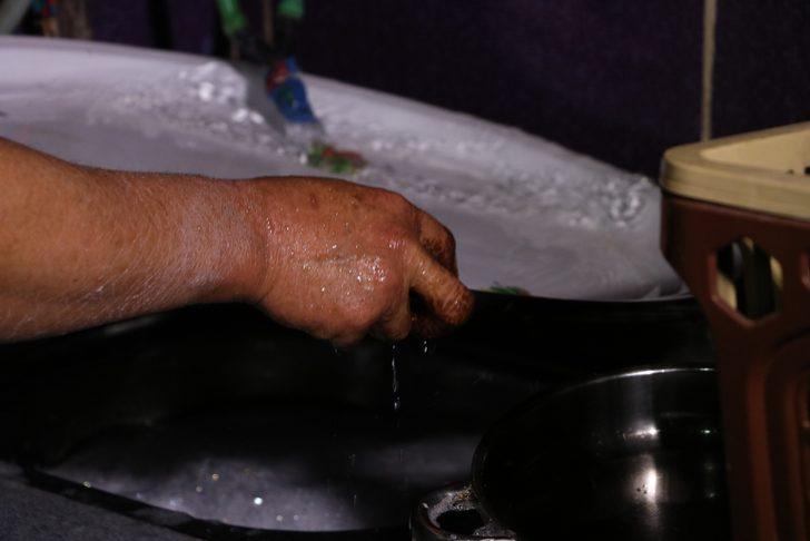 Bu hastalık 7 mahallenin kabusu oldu! 'Yemek yerken dışlandım, otobüse alınmadım' G4