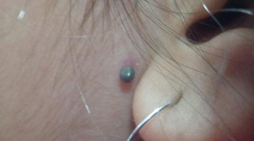 Sokakta oynuyordu! Kulağında görünce hemen doktora koştu