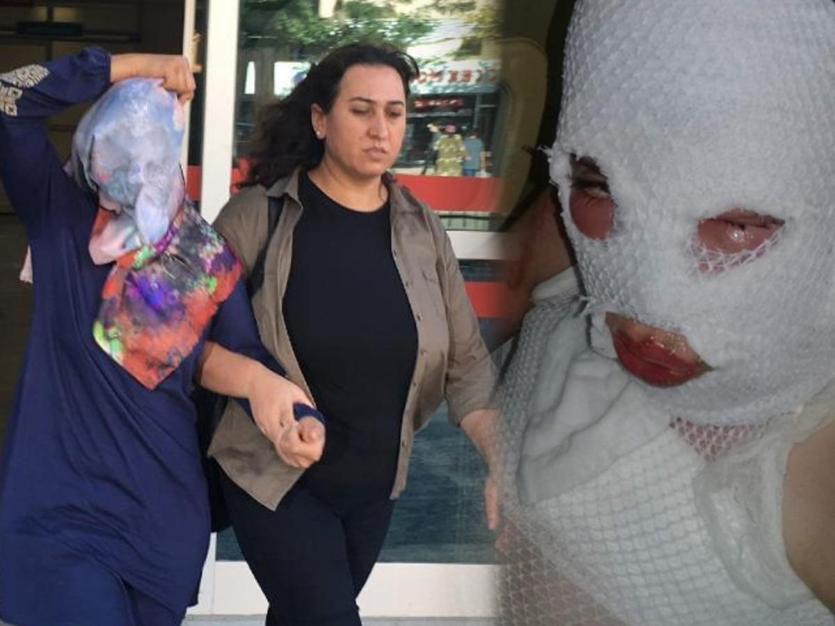 Konya'da 3'&uuml; &ccedil;ocuk 6 kişiyi kezzap ile yakan G&uuml;lay Durusoy'a 10 yıl hapis cezası