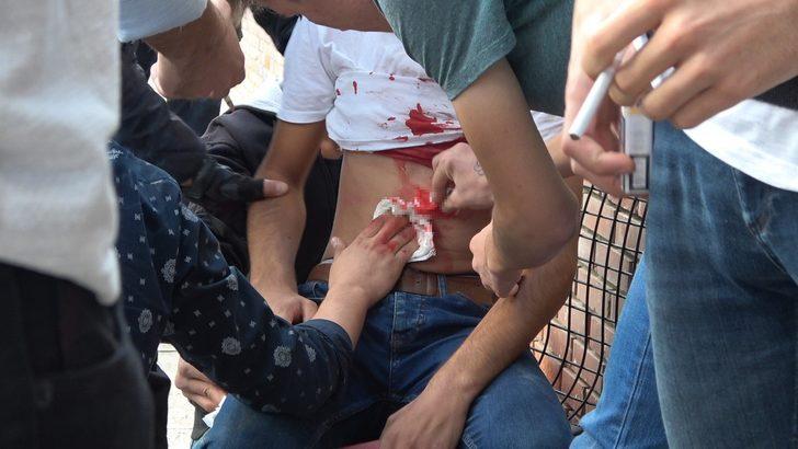 Bıçaklanan gencin yaptıkları şaşkına çevirdi G1