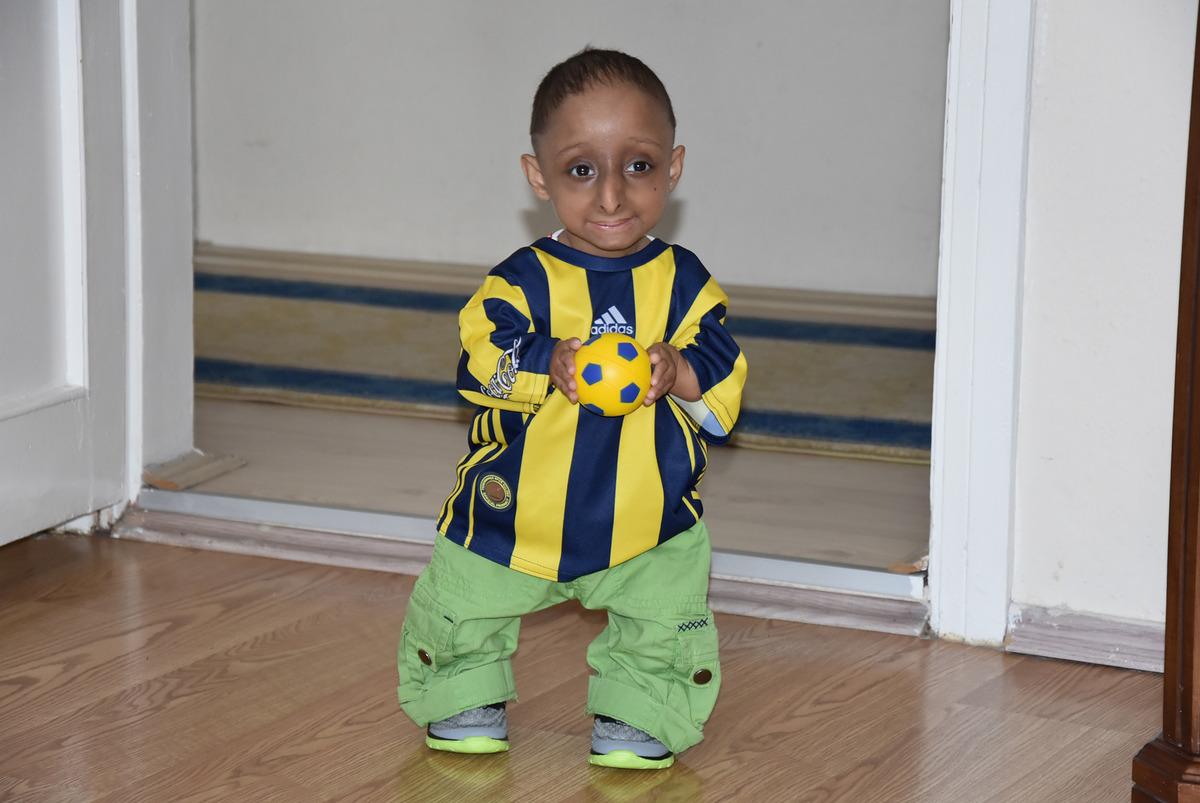 Milyonda bir g&ouml;r&uuml;l&uuml;yor... 14 yaşındaki İlker, 4 kilo ağırlığında, 65 santimetre boyunda