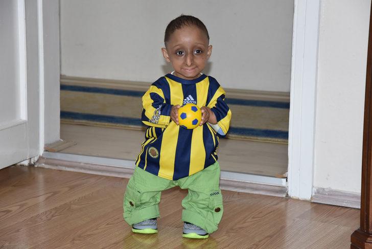 Milyonda bir görülüyor... 14 yaşındaki İlker, 4 kilo ağırlığında, 65 santimetre boyunda G2