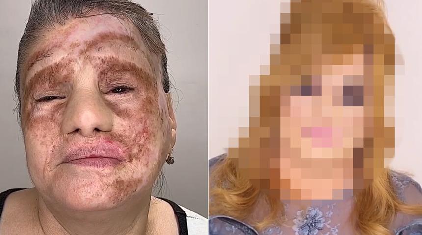 Şaşkına çeviren makyaj dönüşümleri! Makyajın gücü 'vay be' dedirtiyor