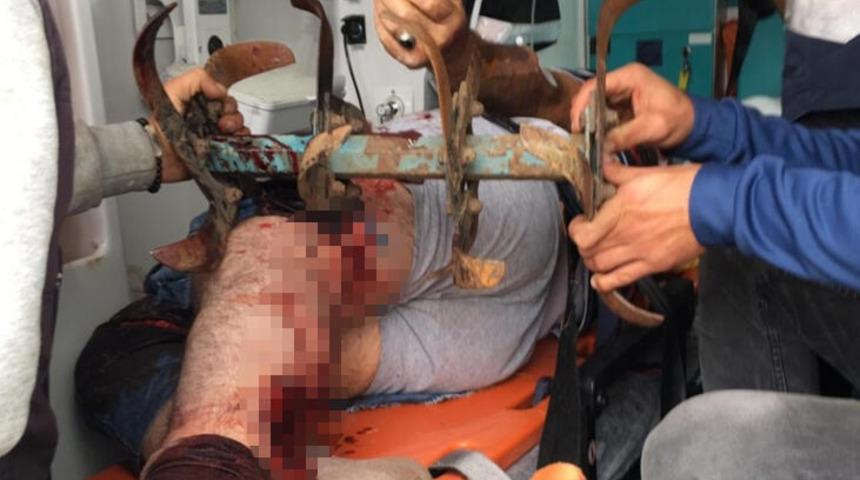 Korkun&ccedil; olay! Bacağındaki &ccedil;apa makinesi ile hastaneye kaldırıldı