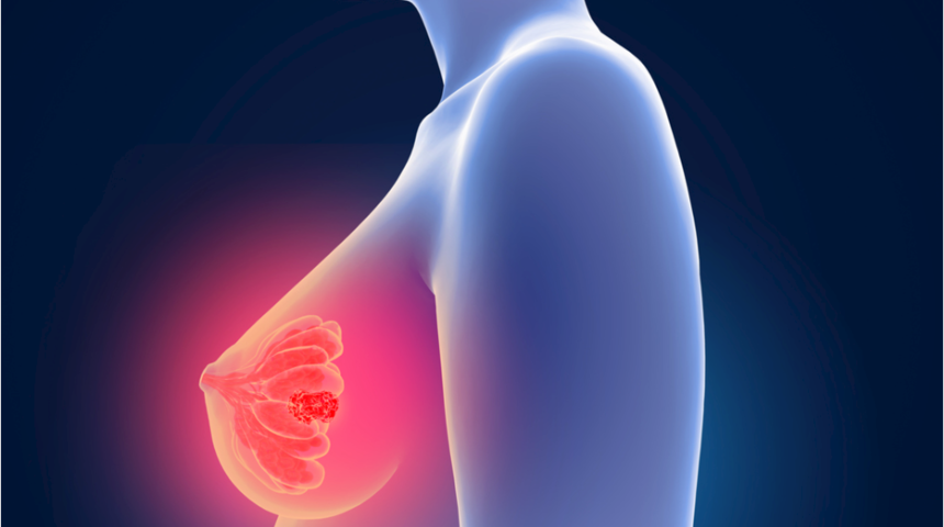 Memedeki ağrısız ve zamanla büyüyen kitleye dikkat 