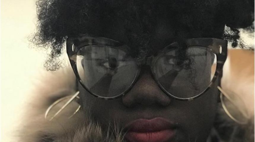 Yıllarca ten rengi y&uuml;z&uuml;nden zorbalığa uğradı şimdi fond&ouml;ten markasının y&uuml;z&uuml; oldu