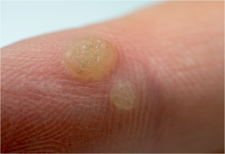 Muzu yedikten sonra kabuğunu atmayın, kullanım ama&ccedil;larını g&ouml;r&uuml;nce şaşıracaksınız