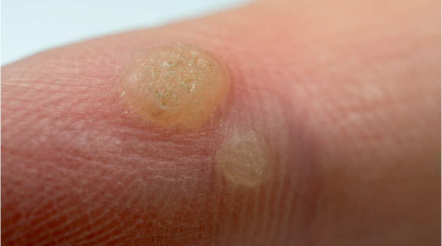 Muzu yedikten sonra kabuğunu atmayın, kullanım ama&ccedil;larını g&ouml;r&uuml;nce şaşıracaksınız