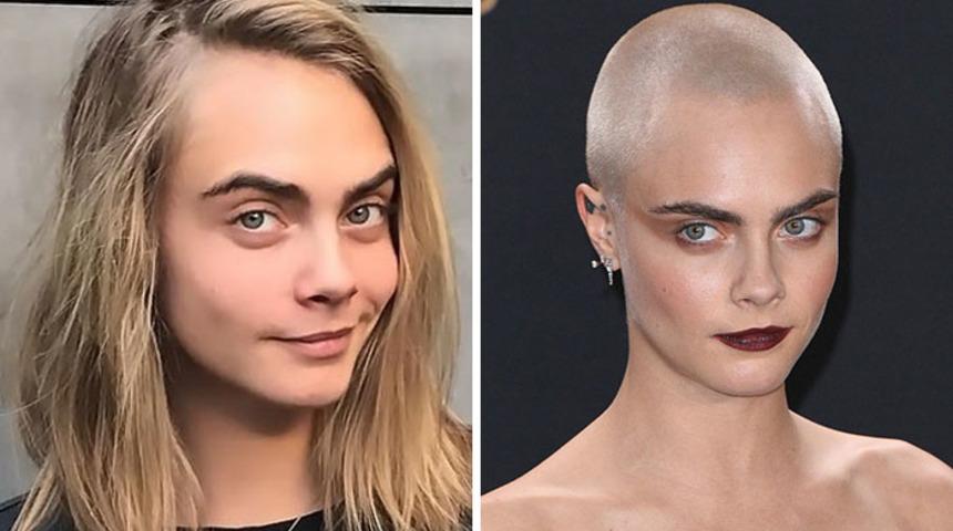 Saçlarını kazıtan 30 ünlünün öncesi ve sonrası!