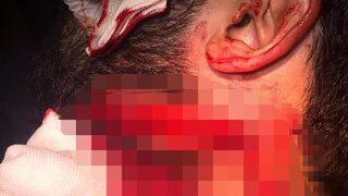 Korkunç saldırı! Jiletle boğazından yaraladı