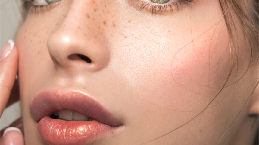 Ameliyatsız yüz germe neden farklı isimlerle adlandırılıyor, farkları var mı?