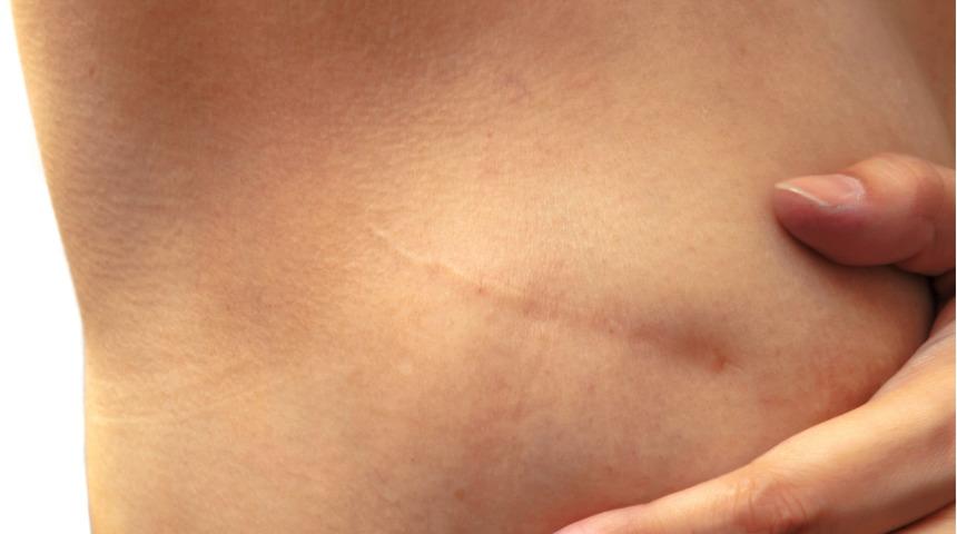 Sigara ve alkol kullanmak meme kanserini tetikliyor