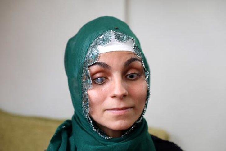 21 yaşında ilk kez kendisini gördü! G4