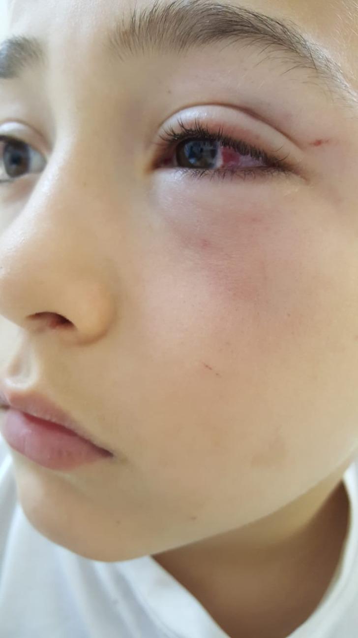 9 yaşındaki küçük çocuk dehşeti yaşadı G2