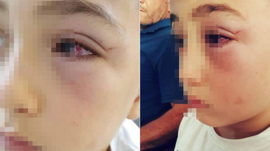 9 yaşındaki çocuğu darp etti! Nedeni şaşkına çevirdi