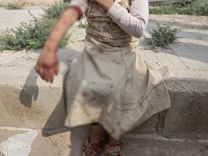 Tel Abyad'da YPG/PKK'dan hain tuzak: 1'i çocuk 3 kişi yaralandı G3