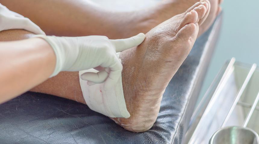 Gut hastalığı tedavisi nedir? Gut hastalığına iyi gelen besinler