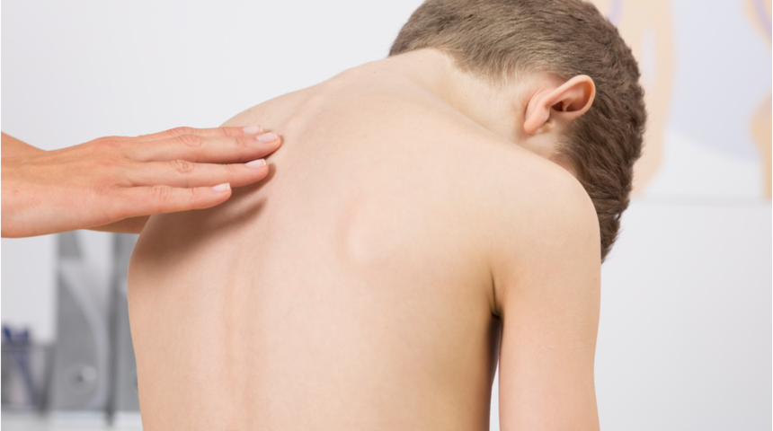 Okul &ccedil;ağındaki &ccedil;ocuklarda 6 skolyoz belirtisi