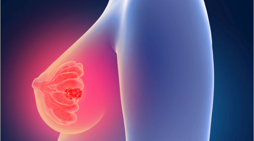 Uzmanından &ouml;nemli uyarı: Her b&uuml;y&uuml;k t&uuml;m&ouml;r ileri evre kanser değil