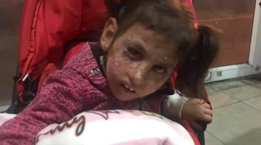 Kanser hastası kız i&ccedil;in 3 saate 25 bin TL toplandı