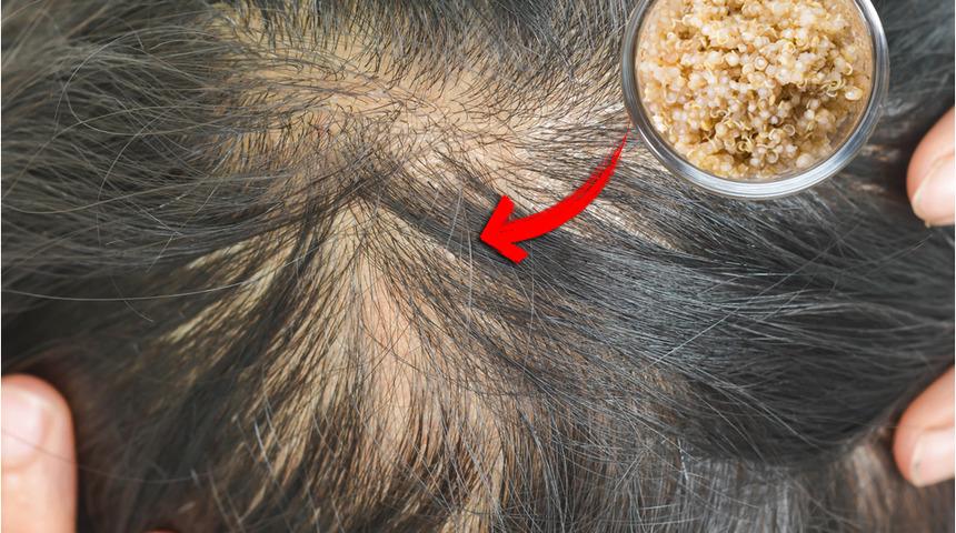 Kadın sağlığına fayda sağlayan yiyecek ve içecekler