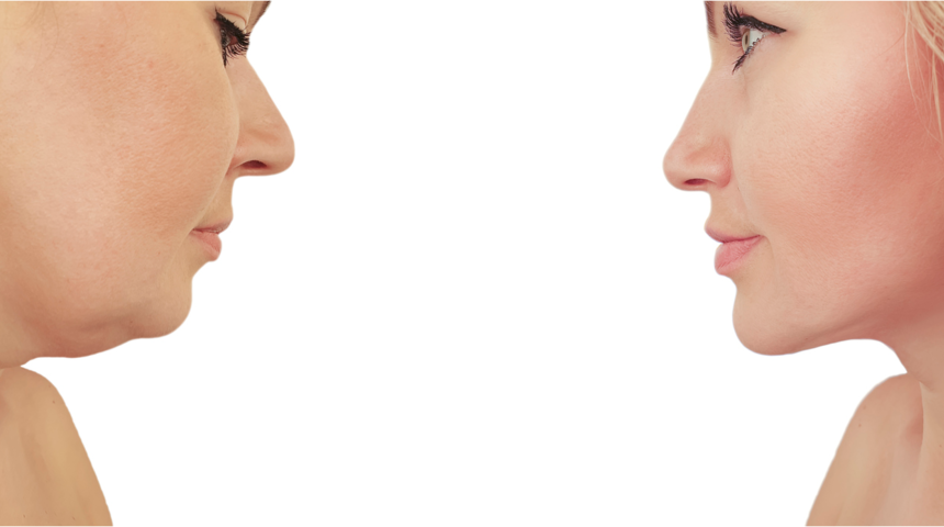 Dünyada da talep gören PB serum ne işe yarıyor?