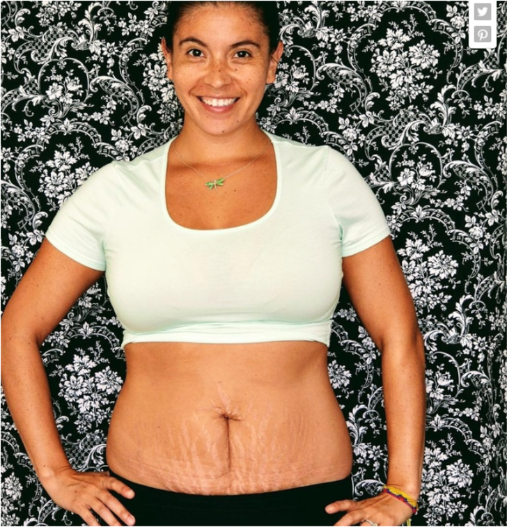 Doğum sonrası vücutlarıyla gurur duyan kadınlar anneliğin gerçek yolculuğunu gösteriyor G2