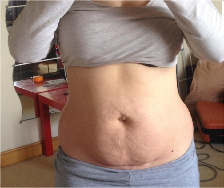 Doğum sonrası vücutlarıyla gurur duyan kadınlar anneliğin gerçek yolculuğunu gösteriyor G3