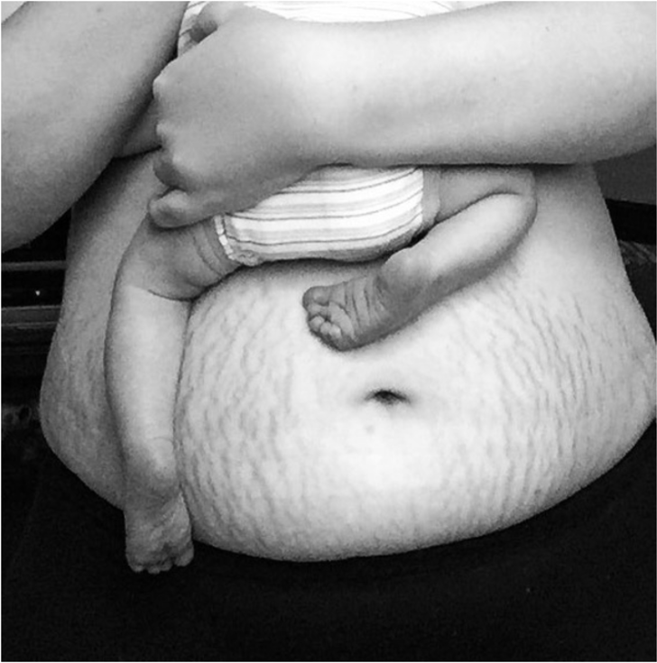 Doğum sonrası vücutlarıyla gurur duyan kadınlar anneliğin gerçek yolculuğunu gösteriyor G4