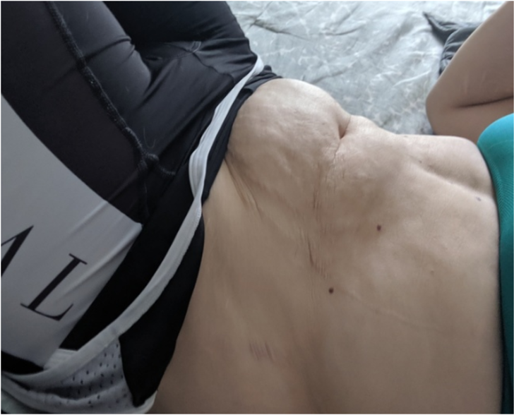 Doğum sonrası vücutlarıyla gurur duyan kadınlar anneliğin gerçek yolculuğunu gösteriyor G5