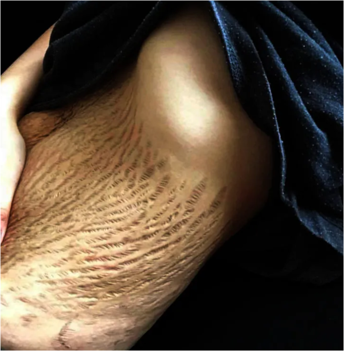 Doğum sonrası v&uuml;cutlarıyla gurur duyan kadınlar anneliğin ger&ccedil;ek yolculuğunu g&ouml;steriyor