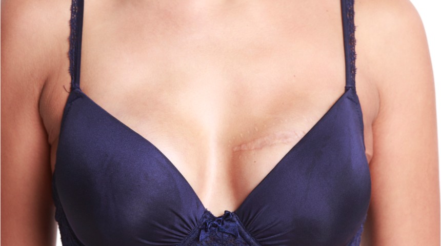 Her 18 saniyede bir kadına meme kanseri tanısı konuyor