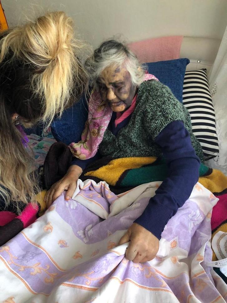Zonguldak'ta yaşlı kadına şiddet! Bakıcısı tarafından bu hale getirildi G2