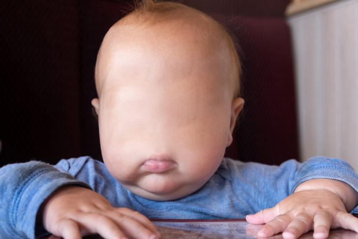Bebek yüzü olmadan dünyaya geldi, doğum uzmanı doktor açığa alındı