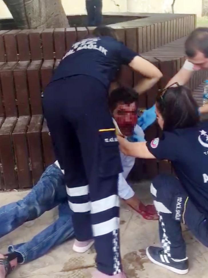 Parkta korkunç görüntü! Yumruk attığı arkadaşının burnunu yırttı G5