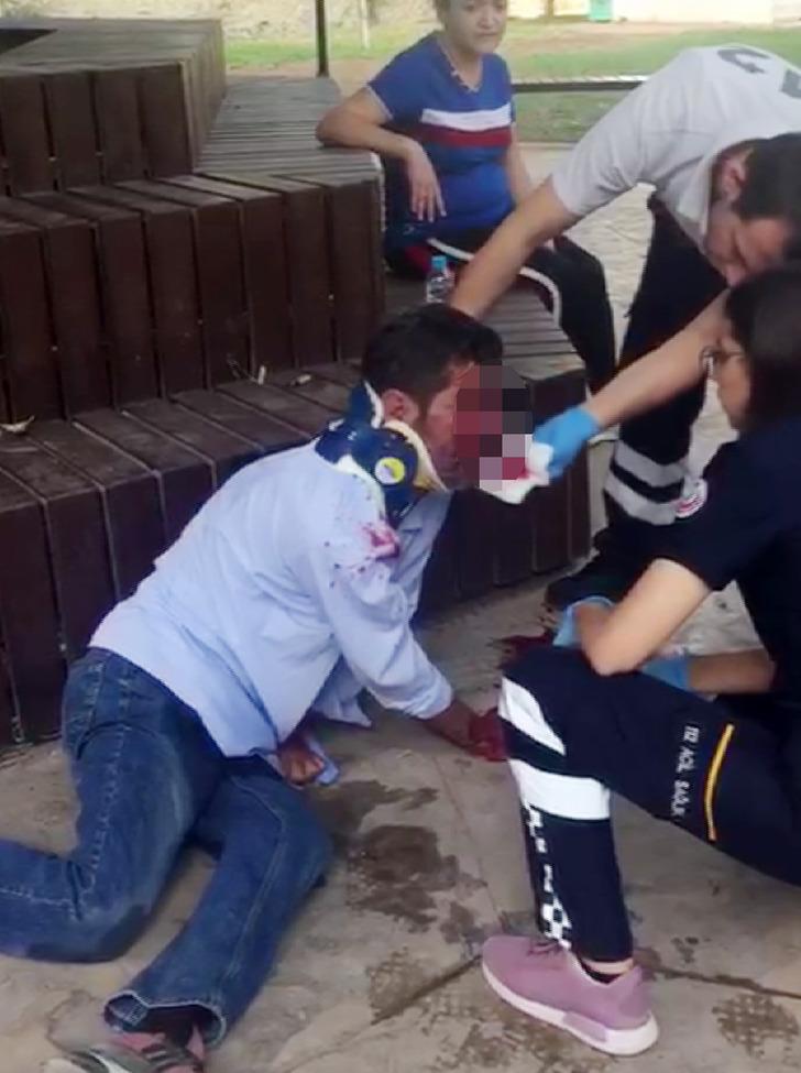 Parkta korkunç görüntü! Yumruk attığı arkadaşının burnunu yırttı G3