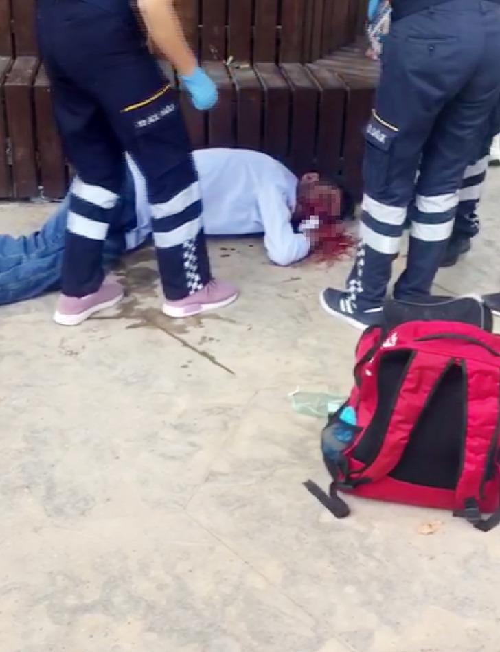 Parkta korkunç görüntü! Yumruk attığı arkadaşının burnunu yırttı G2