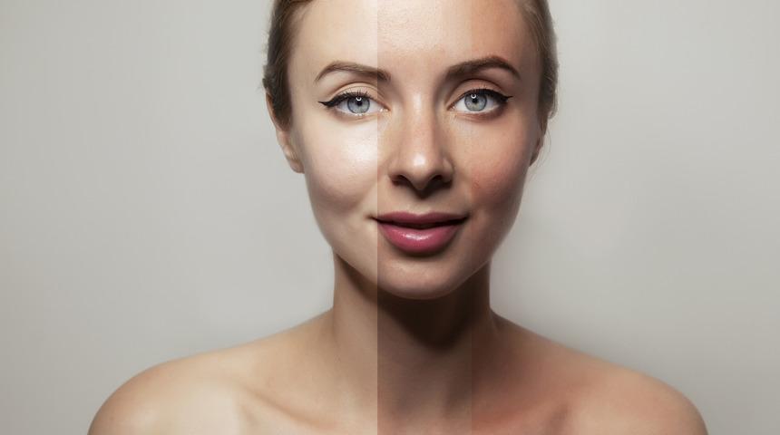 Güzelliğin sırrı porselen cilt uygulamasında