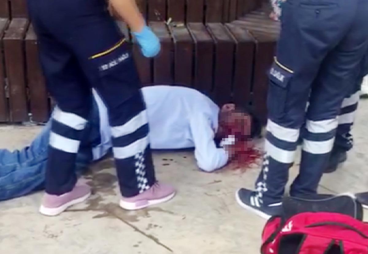 Parkta korkun&ccedil; g&ouml;r&uuml;nt&uuml;! Yumruk attığı arkadaşının burnunu yırttı