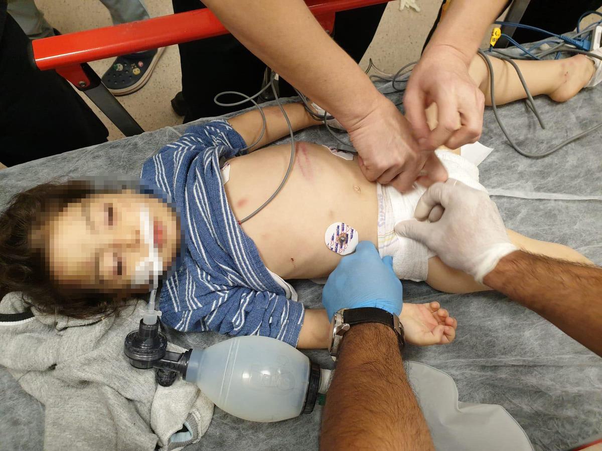 Adana'da korkun&ccedil; olay! &Uuml;vey annesinin d&ouml;vd&uuml;ğ&uuml; minik Nurcan beyin kanaması ge&ccedil;irdi