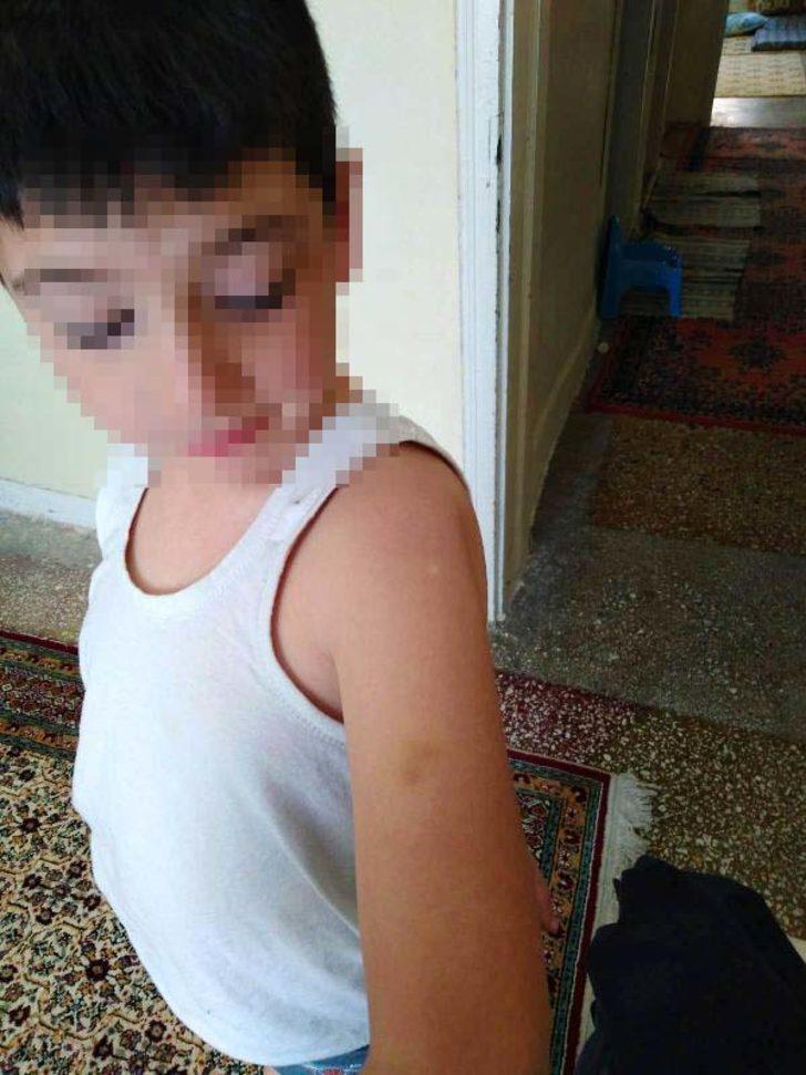 Mardin'de okulda korkunç iddia: Öğretmenden epilepsi öğrencisine darp G3