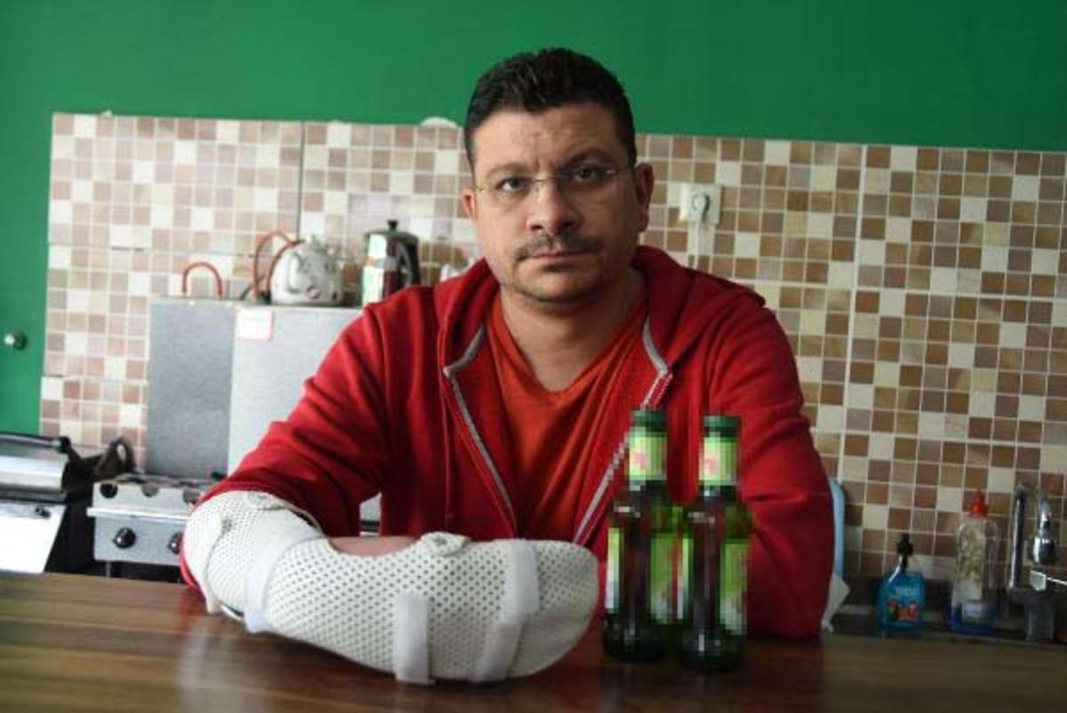 Herkesin başına gelebilir! Soda şişelerini a&ccedil;maya &ccedil;alışırken elinde patladı