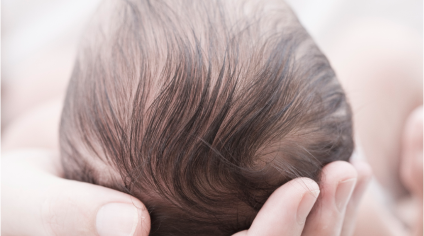 Bebeğinizin kafasında şekil bozukluğu varsa dikkat! Kraniosinostoz, beynin büyümesini engelliyor