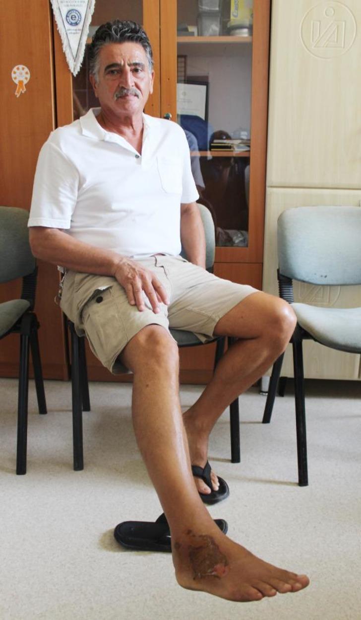 Antalya'da balıkçının ayağına düşen 'aslan balığı' öldürüyordu G1