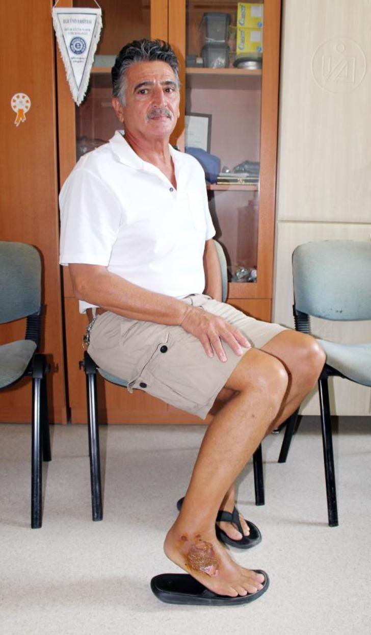 Antalya'da balıkçının ayağına düşen 'aslan balığı' öldürüyordu G2